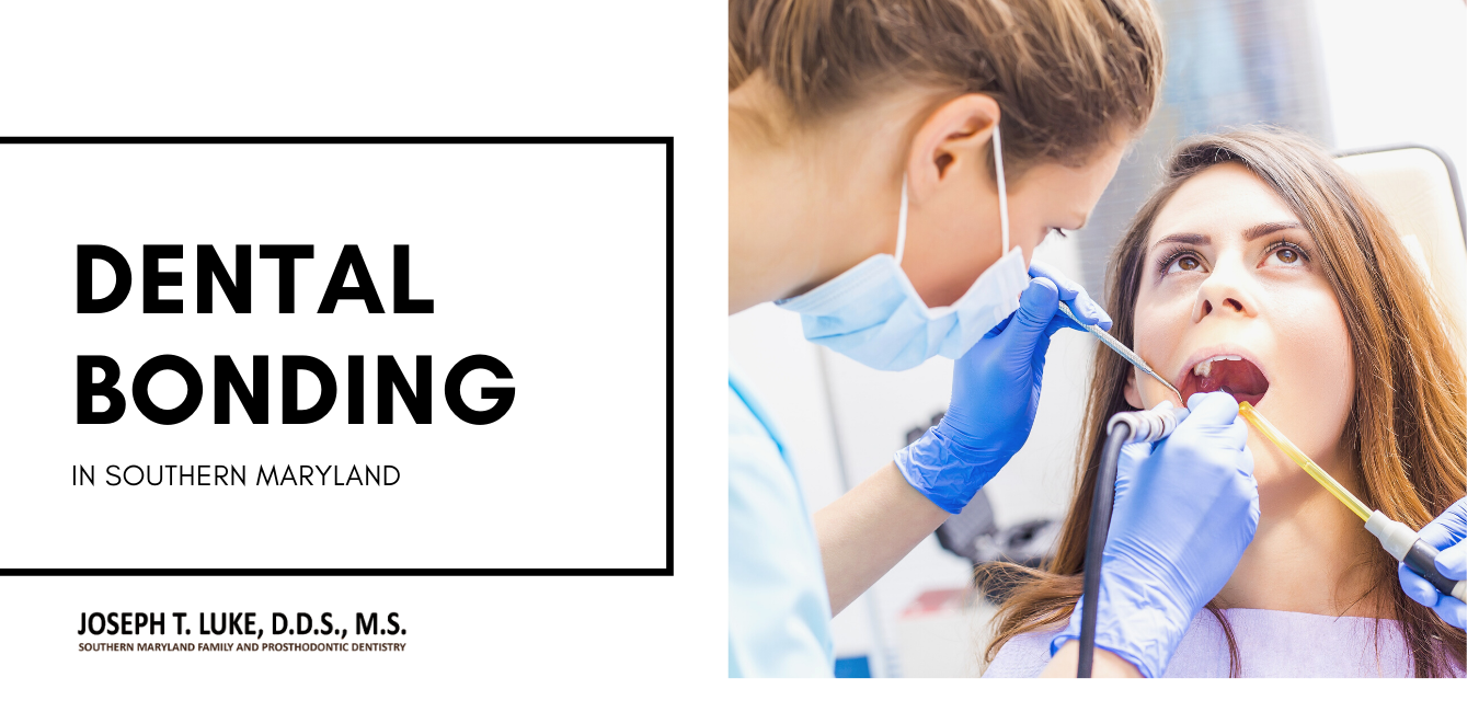 Dental Bonding Southern Maryland