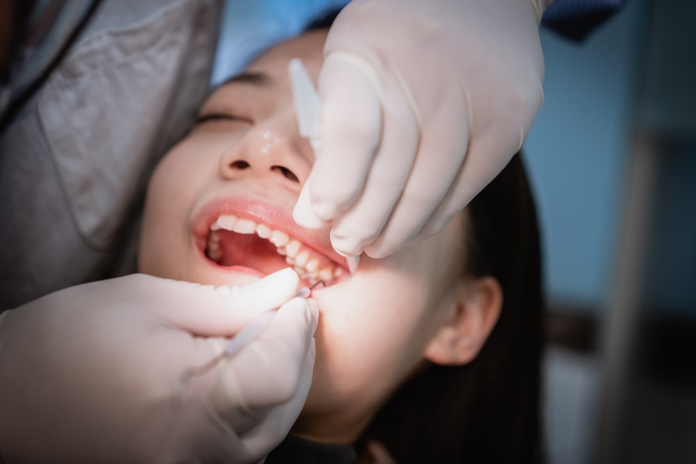 Same-Day Tooth Extraction in Leonardtown