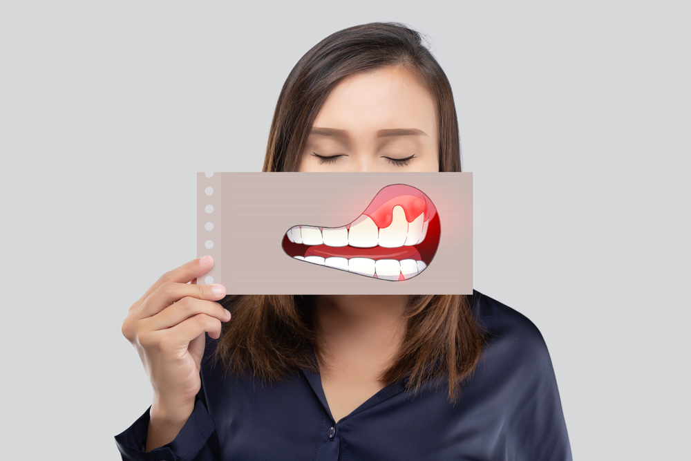 Where Can I Get a Tooth Extraction Now in Southern Maryland?