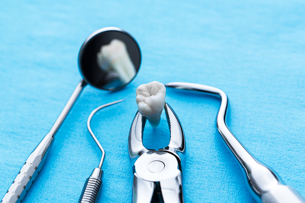How Much Does a Tooth Extraction Cost in Leonardtown?