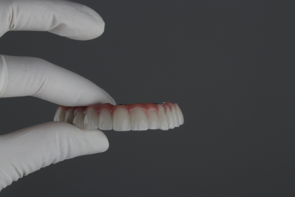 full arch dental implants in Calvert County