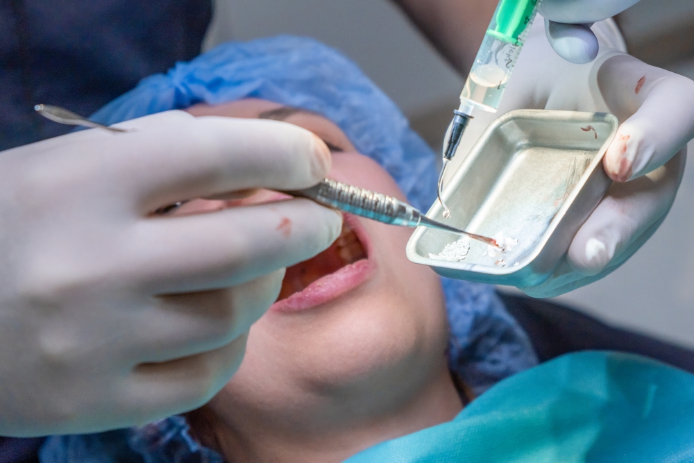 dentist performing a bone graft before installing dental implants