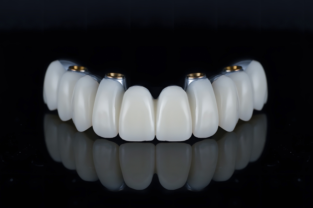 all-on-4 full arch dental implants in Calvert County