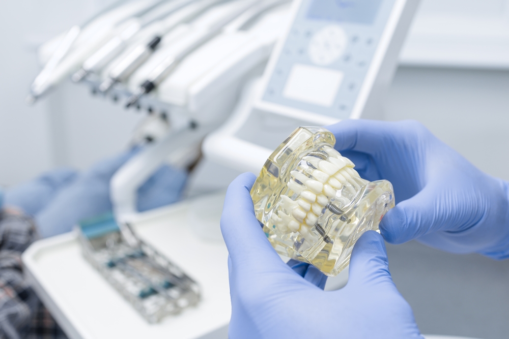 Screw-Retained dentures in Maryland